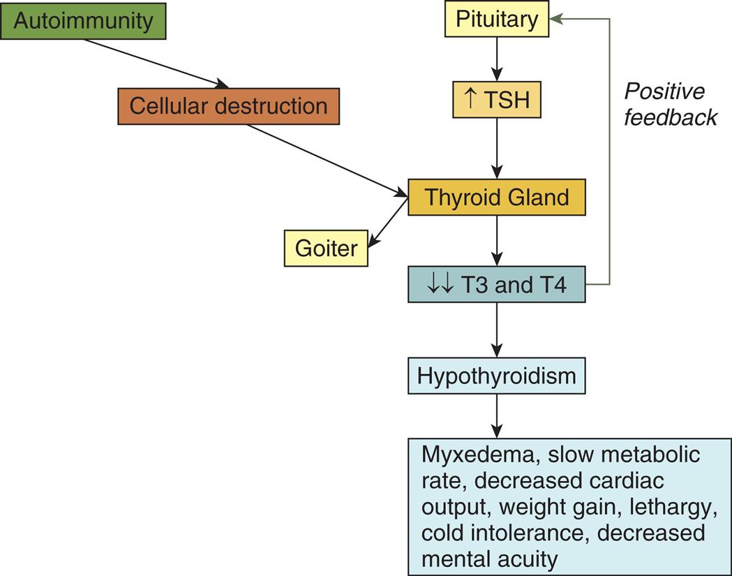 A flowchart shows two pathways representing the pathophysiology of Hashimoto thyroiditis. One of the pathways is as follows. • Autoimmunity. • Cellular destruction. • Thyroid gland. • Goiter. The other pathway is as follows. • Pituitary. • Increased T S H. • Thyroid gland. • Decreased T 3 and T 4. (positive feedback to pituitary) • Hypothyroidism. • Myxedema, slow metabolic rate, decreased cardiac output, weight gain, lethargy, cold intolerance, and decreased mental acuity.