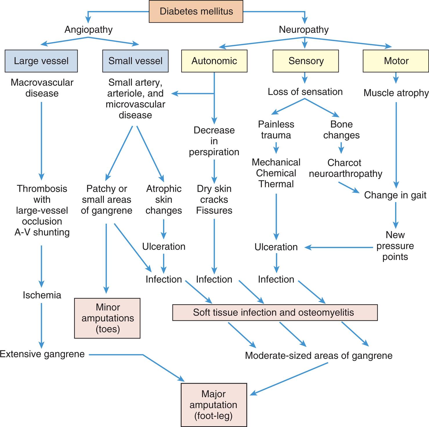 A flowchart shows how foot lesions of diabetes lead to amputation. Diabetes can lead to angiopathy or neuropathy. The pathways that lead to amputation (foot-leg) are as follows. 1. Large vessel (from angiopathy); macrovascular disease. Leads to 2. 2. Thrombosis with large-vessel occlusion A-V shunting. Leads to 3. 3. Ischemia. Leads to 4. 4. Extensive gangrene. Leads major amputation (foot-leg). 5. Small vessel (small artery, arteriole, and microvascular disease). Leads to 6 and 7. 6. Patchy or small areas of gangrene. Leads to minor amputations (toes) and 9. 7. Atrophic skin changes. Leads to 8. 8. Ulceration. Leads to 9. 9. Infection. Leads to 10. 10. Soft tissue infection and osteomyelitis. Leads to 11. 11. Moderate-sized areas of gangrene. Leads to major amputation (foot-leg). 12. Autonomic (from neuropathy). Leads to 5 and 13. 13. Decrease in perspiration. Leads to 14. 14. Dry skin cracks; fissures. Leads to 9. 15. Sensory (from neuropathy). Leads to 16. 16. Loss of sensation. Leads to 17 and 18. 17. Painless trauma. Leads to 19. 18. Bone changes. Leads to 21. 19. Mechanical, chemical, thermal. Leads to 20. 20. Ulceration. Leads to 9. 21. Charcot neuroarthropathy. Leads to 24. 22. Motor (from neuropathy). Leads to 23. 23. Muscle atrophy. Leads to 24. 24. Change in gait. Leads to 25. 25. New pressure points. Leads to 20.