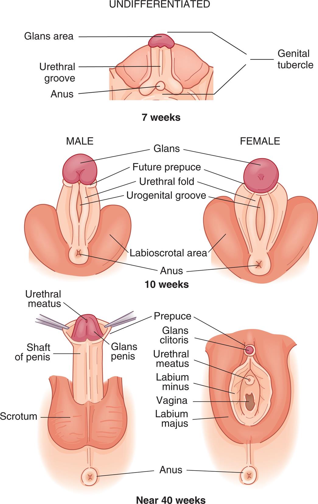 “A series of illustrations show and label the structures in an undifferentiated, the male, and the female external genitalia. Top panel, undifferentiated, seven weeks. The following structures on the illustration are labeled, from the top to the bottom: genital tubercle, glans area, urethral groove, anus, and genital tubercle. Middle panel, male and female, ten weeks. The following structures on the illustration are labeled, from the top to the bottom: glans, future prepuce, urethral fold, urogenital groove, labioscrotal area, and anus. Bottom panel, male and female, forty weeks. The following structures on the male genitalia are labeled, from the top to the bottom: urethral meatus, prepuce, glans penis, shaft of penis, scrotum, and anus. The following structures on the female genitalia are labeled, from the top to the bottom: prepuce, glans clitoris, urethral meatus, labium minus, vagina, labium majus, and anus.”