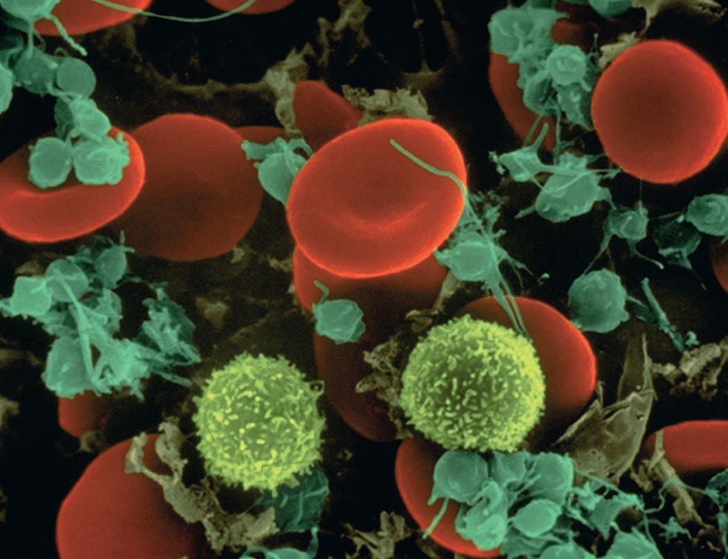 An electron micrograph shows red blood cells surrounded by lymphocytes and platelets.