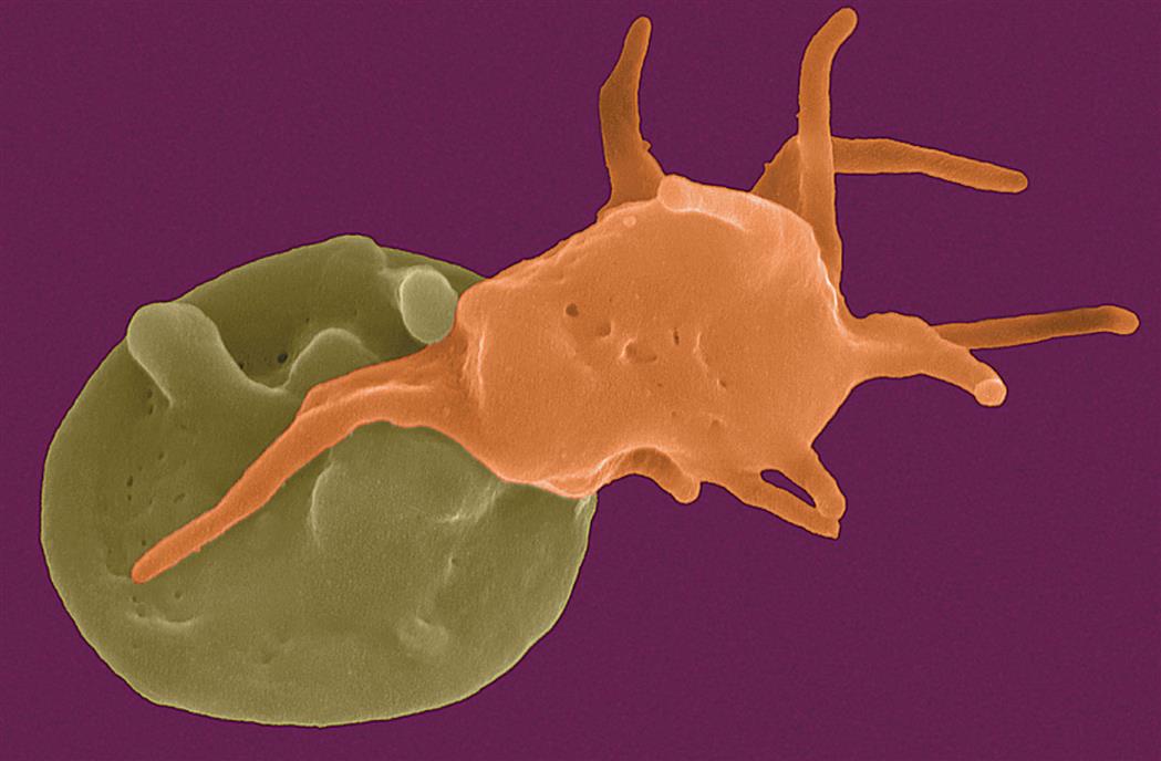A photomicrograph shows a fully activated platelet attached to a moderately activated platelet.