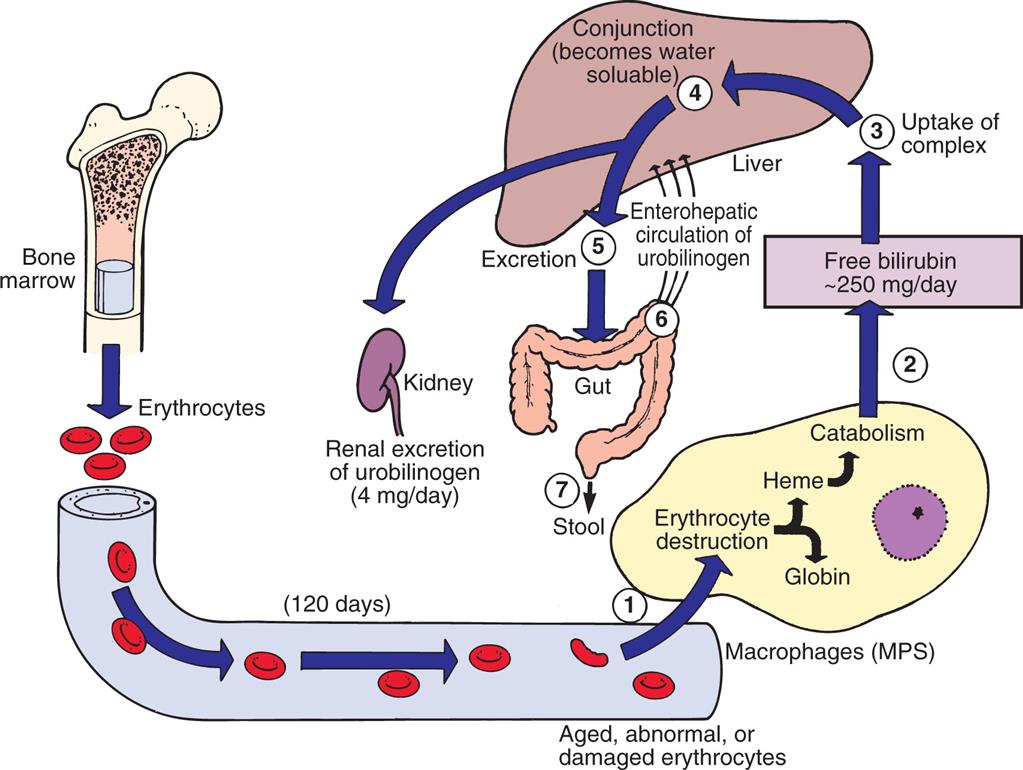 An illustration shows the metabolism of bilirubin released by heme. Erythrocytes from the bone marrow, at 120 days, become aged, abnormal, or damaged. 1. Erythrocytes are attracted to the macrophages (M P S), where they are destructed as heme or globin. 2. Heme undergoes catabolism releasing free bilirubin by 250 milligrams per day. 3. Uptake of complex. 4. Conjunction (becomes water soluble). 5. Excretion. 6. Enterohepatic circulation of urobilinogen. 7. Urobilinogen is excreted as stool. Conjunction also triggers the kidney, supporting the renal excretion of urobilinogen of 4 milligrams per day.