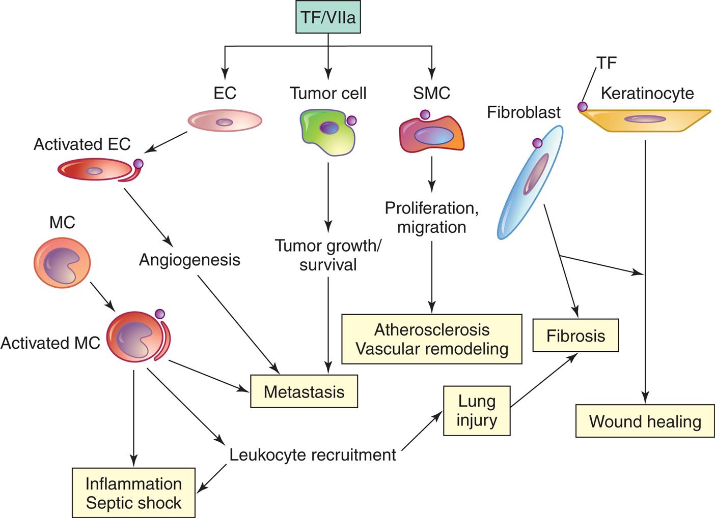 A flowchart illustrates tissue factor (T F) and disease. 1. T F or factor 7 a. Leads to 2, 3, and 4. 2. E C. Leads to 5. 3. Tumor cell. Leads to 8. 4. S M C. Leads to 9. 5. Activated E C. Leads to 6. 6. Angiogenesis. Leads to 7. 7. Metastasis. 8. Tumor growth or survival. Leads to 7. 9. Proliferation and migration. Leads to 10. 10. Atherosclerosis and vascular remodeling. 11. M C. Leads to 12. 12. Activated M C. Leads to 7, 13, and 14. 13. Leukocyte recruitment. Leads to 15. 14. Inflammation and septic shock. 15. Lung injury. Leads to 16. 16. Fibrosis. 17. Fibroblast. Leads to 16 and 19. 18. T F on keratinocyte. Leads to 19. 19. Wound healing.