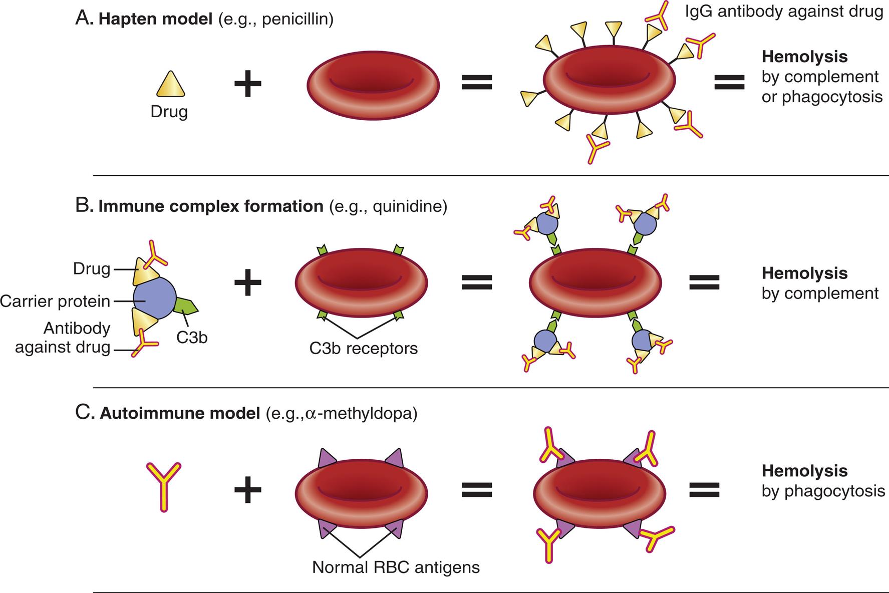 Three illustrations show models of drug induced hemolytic anemia. Top panel, A. Hapten model (example, penicillin). The illustration shows: drug plus red blood cell bound with I g G antibody against drug equals hemolysis by complement or phagocytosis. Middle panel, B. Immune complex formation (example, quinidine). The illustration shows: carrier protein (has C 3 b component) with drug and antibody against drug plus blood cell with C 3 b receptors equals blood cell with C 3 b receptors attracting carrier proteins equals hemolysis by complement. Bottom panel, C. Autoimmune model (example, alpha-methyldopa). I g G antibody plus blood cell with normal R B C antigens equals blood cell with normal R B C antigens attracting I g G antibody equals hemolysis by phagocytosis.