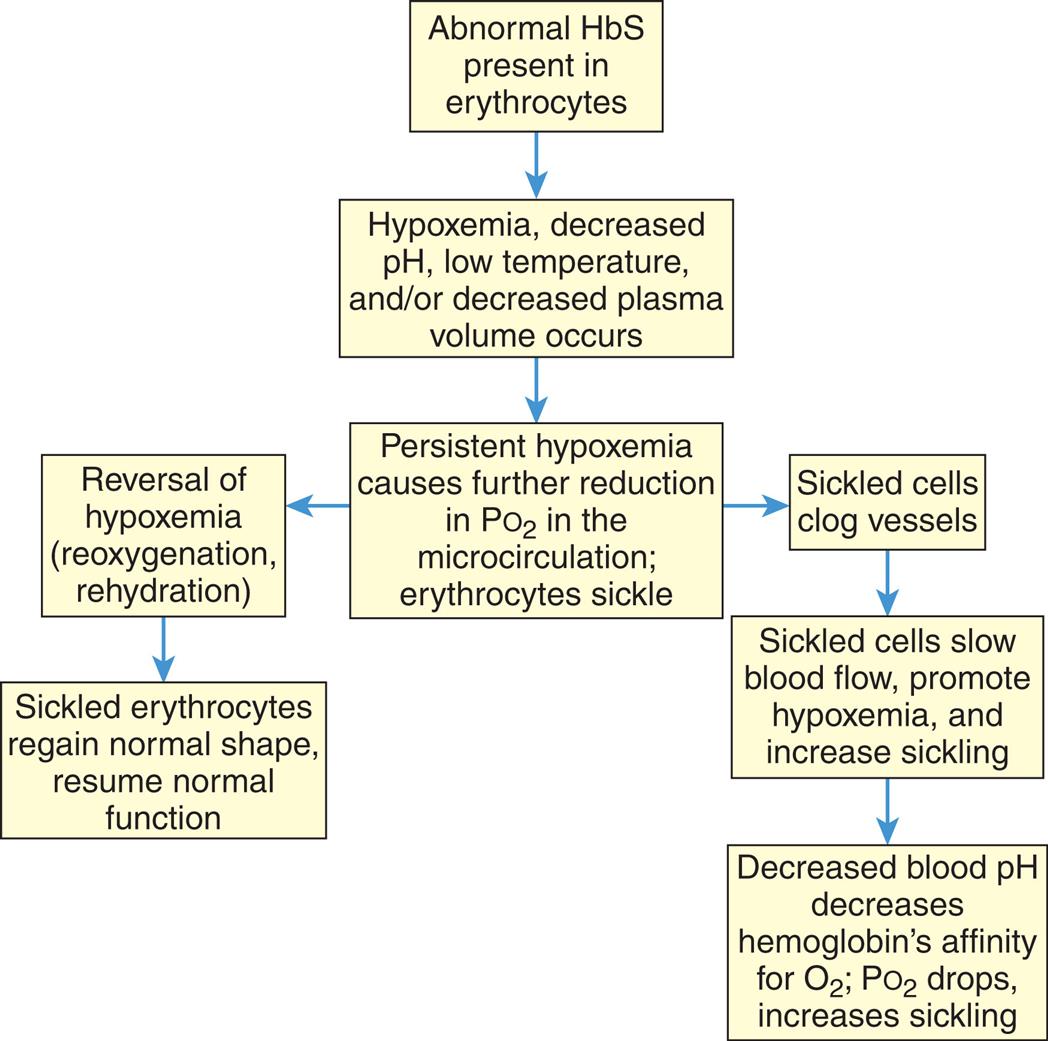 A flowchart shows the sequence of sickling of erythrocytes. 1. Abnormal H b S present in erythrocytes. Leads to 2. 2. Hypoxemia, decreased p H, low temperature, and or decreased plasma volume occurs. Leads to 3. 3. Persistent hypoxemia causes further reduction in partial pressure of oxygen in the microcirculation; erythrocytes sickle. Leads to 4 and 6. 4. Reversal of hypoxemia (reoxygenation, rehydration). Leads to 5. 5. Sickled erythrocytes regain normal shape, resume normal function. 6. Sickled cells clog vessels. Leads to 7. 7. Sickled cells slow blood flow, promote hypoxemia, and increase sickling. Leads to 8. 8. Decreased blood p H decreases hemoglobin’s affinity for oxygen; partial pressure of oxygen drops, increases sickling.