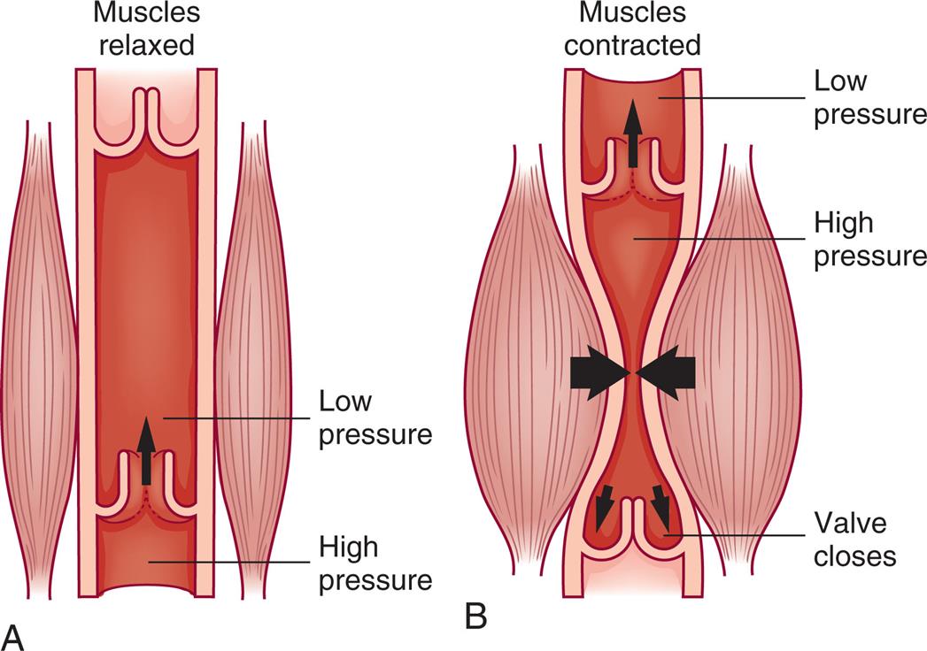 Left panel, A. The illustration shows a vein when the muscles are relaxed. The vein is normal with blood from high-pressure zone flowing through the opening and into the low-pressure zone. Right panel, B. The illustration shows a vein when the muscles are contracted. The vein is constricted with blood from the high-pressure zone flowing through the opening and into the low-pressure zone.