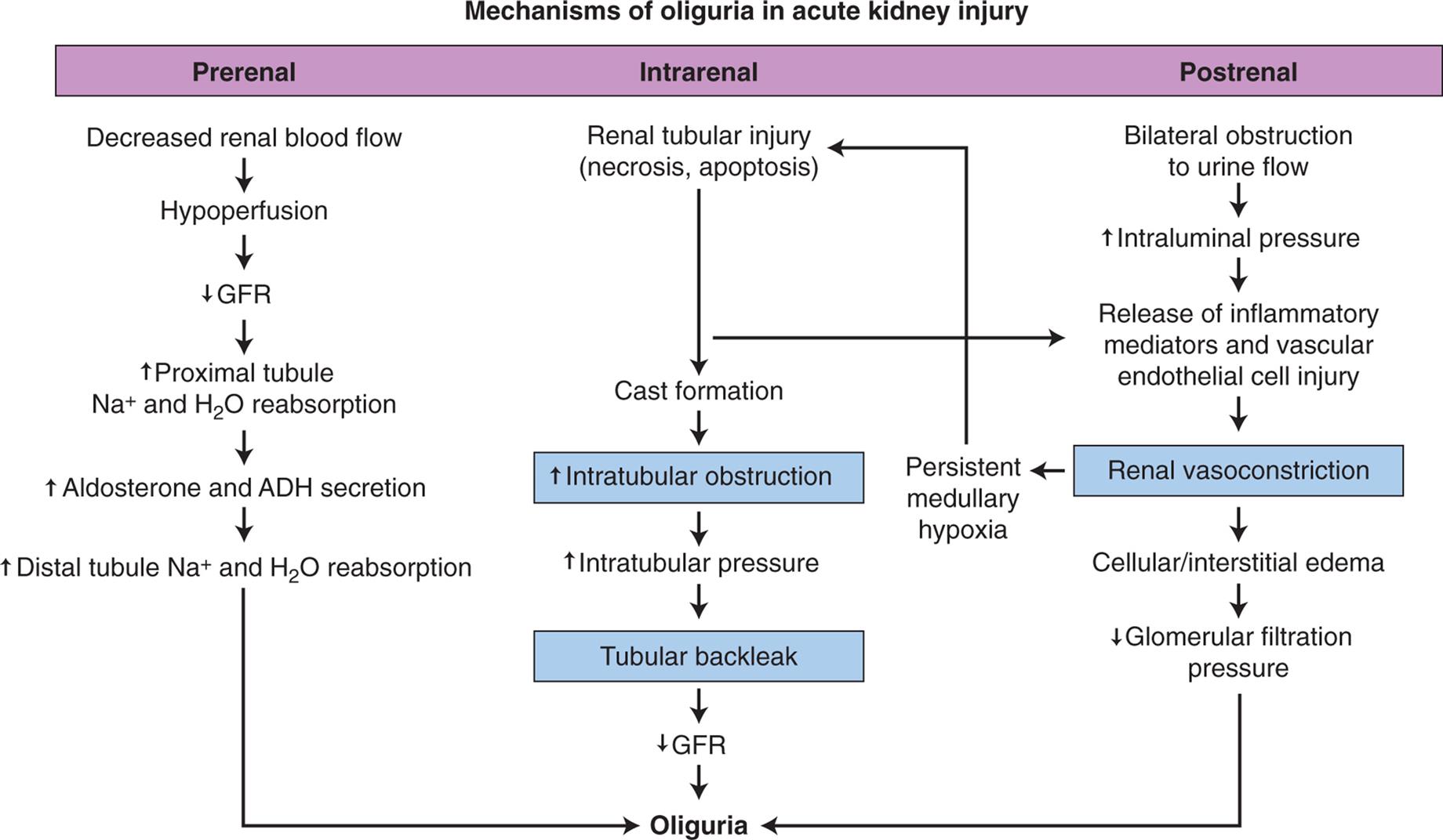 A flowchart shows prerenal, intrarenal, and postrenal mechanisms of oliguria in acute kidney injury. The mechanism for prerenal oliguria is as follows. 1. Decreased renal blood flow. Leads to 2. 2. Hypoperfusion. Leads to 3. 3. Decreased G F R. Leads to 4. 4. Increased proximal tubule; sodium ion and water reabsorption. Leads to 5. 5. Increased aldosterone and A D H secretion. Leads to 6. 6. Increased distal tubule sodium ions and water reabsorption. The mechanism for intrarenal oliguria is as follows. 1. Renal tubular injury (necrosis, apoptosis). Leads to 2 or 3 of postrenal oliguria. 2. Cast formation. Leads to 3. 3. Increased intratubular obstruction. Leads to 4. 4. Increased intratubular pressure. Leads to 5. 5. Tubular back leak. Leads to 6. 6. Increased G F R. The mechanism for postrenal oliguria is as follows. 1. Bilateral obstruction to urine flow. Leads to 2. 2. Increased intraluminal pressure. Leads to 3. 3. Release of inflammatory mediators and vascular endothelial cell injury. Leads to 4. 4. Cellular or interstitial edema. Leads to 5 or persistent medullary hypoxia leading to 1 of intrarenal oliguria. 5. Decreased glomerular filtration pressure.