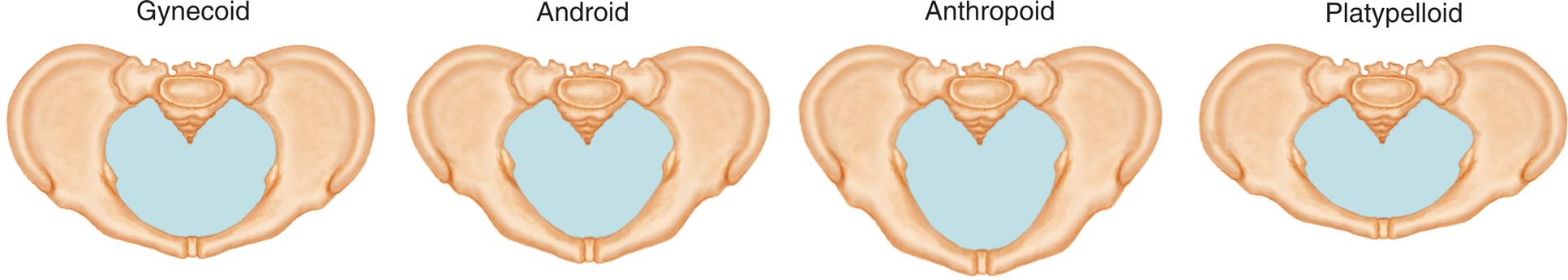 A set of 4 illustrations of different shaped pelvis show types of pelvises from left to right as follows: Gynecoid, Android, Anthropoid, and Platypelloid.