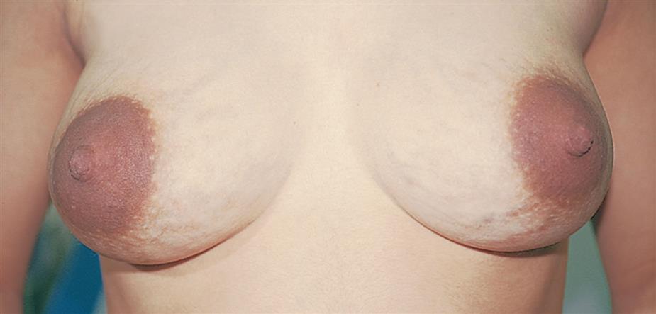 A close-up of bare chest of woman.