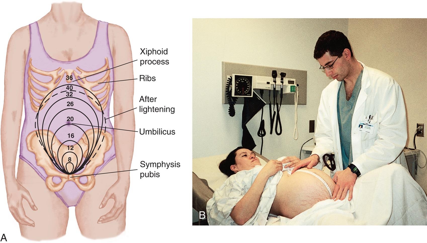A) Illustration of human body shows increasing egg-shaped markings from the symphysis pubis as follows: 8, 12, 16, 20 at umbilicus, 26, 32, 36 at xiphoid process between ribs, and 40 after lightening. B) A health care provider holds the measuring tape from symphysis pubis to fundus of the pregnant woman lying on the bed.
