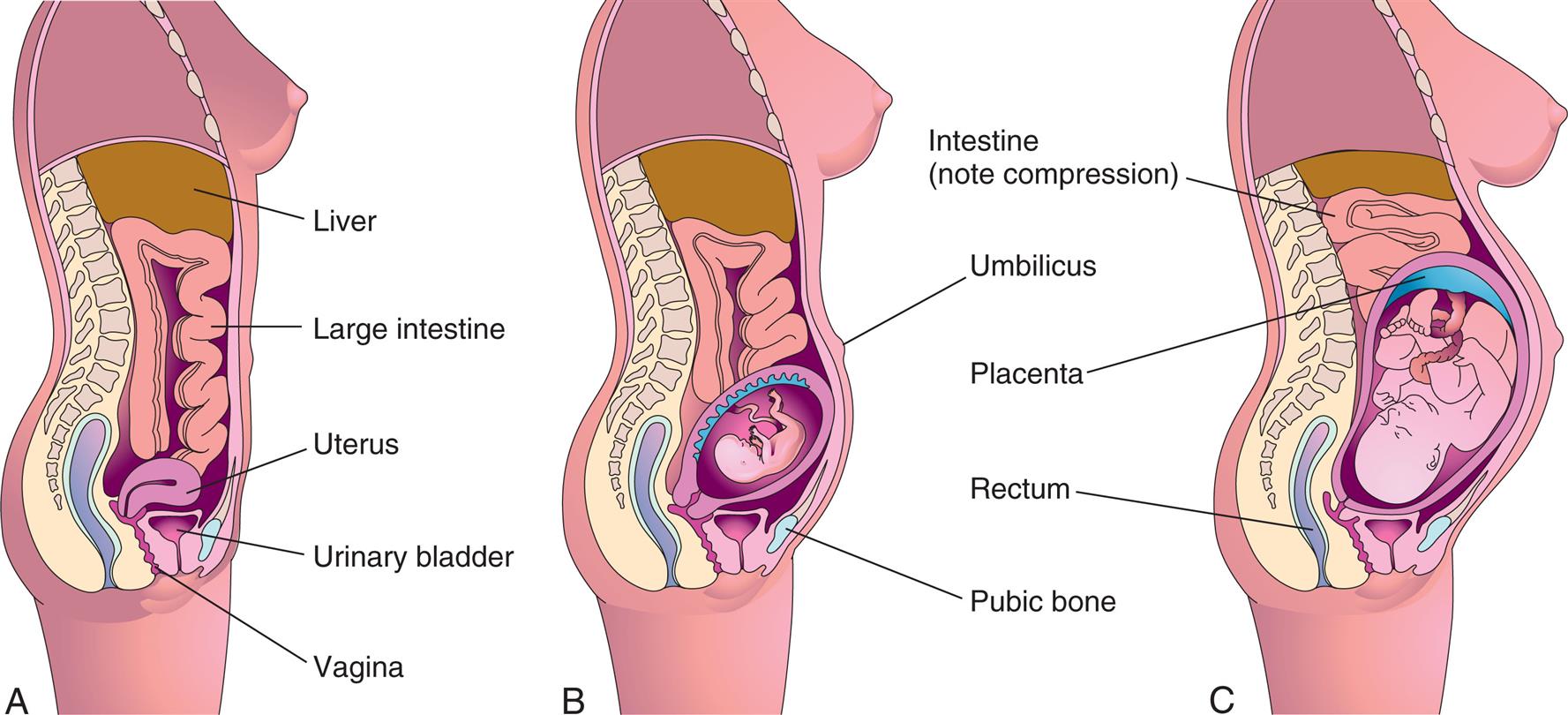 A set of illustration of lateral view of body shows the following from A through C:Part A shows labels for structures from bottom to top as follows: Liver, large intestine, uterus, urinary bladder, and vagina. Part B shows infant in uterus with umbilicus at top and pubic bone at bottom. Part C shows grown infant in uterus with placenta shows rectum and compressed intestine.