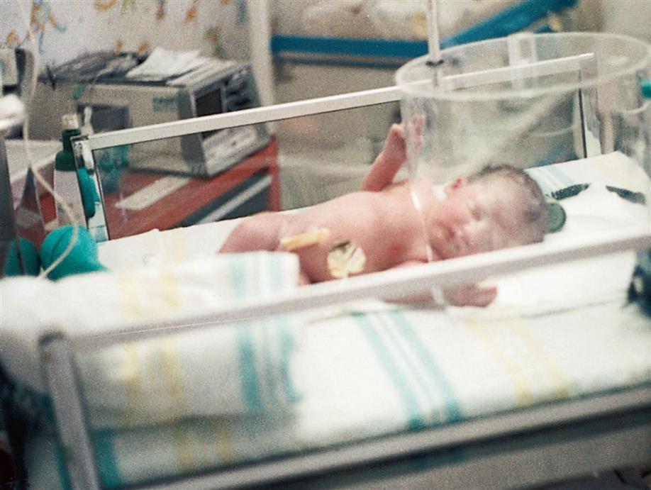 Close-up of a newborn lying supine on bed with oxygen hood above the head.