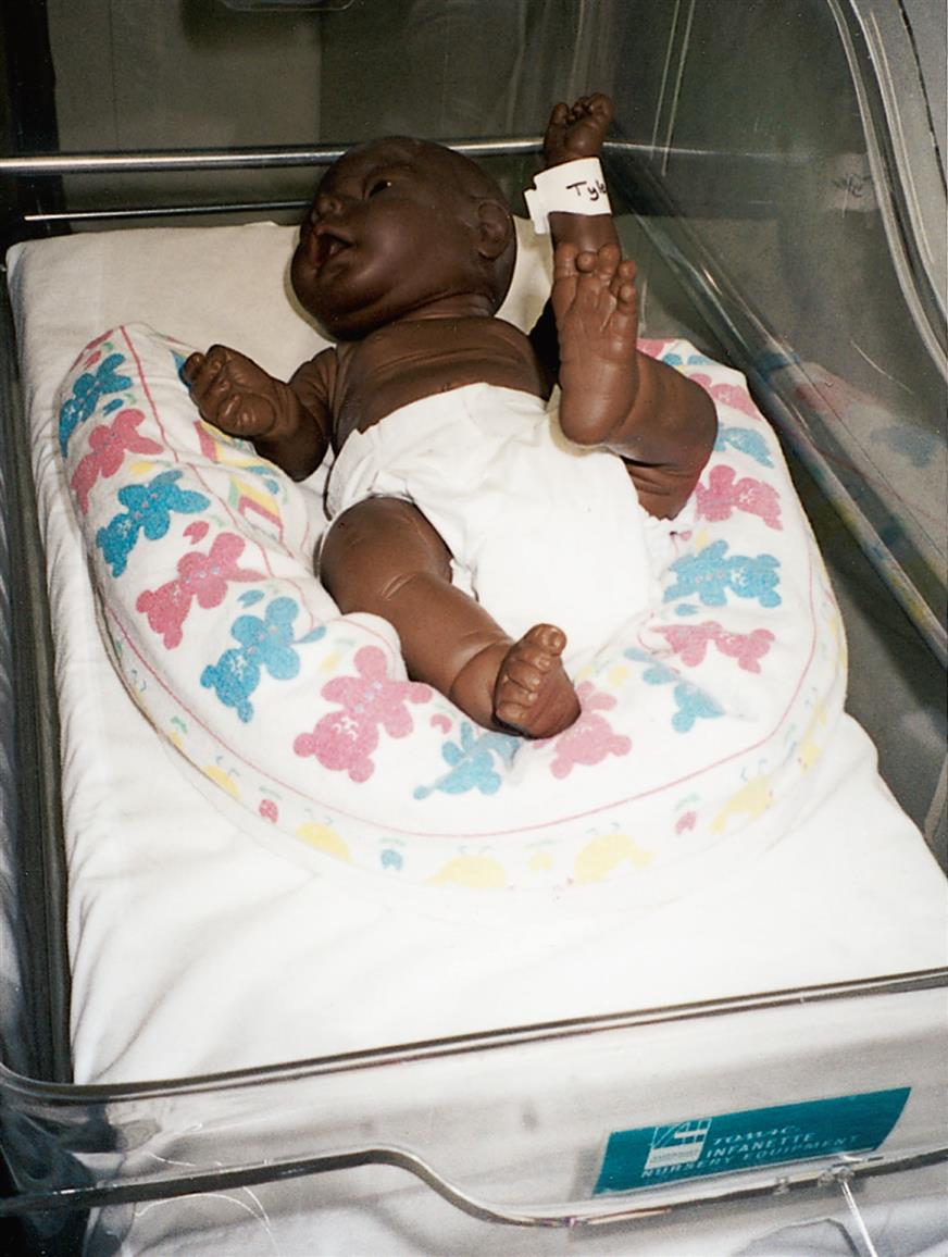 Close-up of prematured baby with identification band on the ankle, supported by rolled, U-shaped blanket.