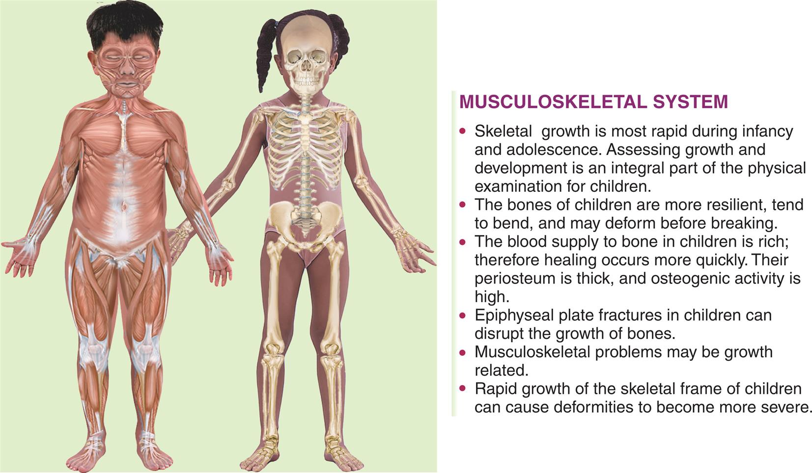 Illustration shows skeletal of little boy and girl. Text under the heading of musculoskeletal system reads as follows: • Skeletal growth is most rapid during infancy and adolescence. Assessing growth and development is an integral part of the physical examination for children. • The bones of children are more resilient, tend to bend, and may deform before breaking. • The blood supply to bone in children is rich; therefore hearing occurs more quickly. Their periosteum is thick, and ostogenic activity is high. • Epiphyseal plate fractures in children can disrupt the growth of bones. • Musculoskeletal problems may be growth related. • Rapid growth of the skeletal frame of children can cause deformities to become more severe.