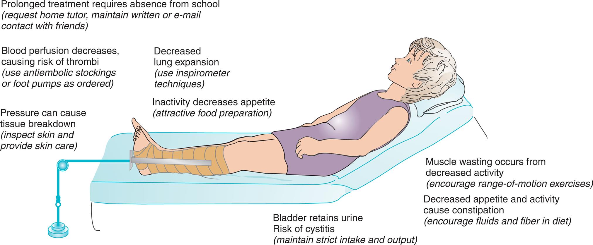 Illustration shows a child lying on bed with trucks and head raised. Effects of traction are as follows: • Prolonged treatment requires absence from school. • Blood perfusion decreases, causing risk of thrombi. • Pressure can cause tissue breakdown. • Decreased lung expansion. • Inactivity decreases appetite. • Bladder retains urine. • Risk of cystitis. • Muscle wasting occurs from decreased activity. • Decreased appetite and activity cause constipation.