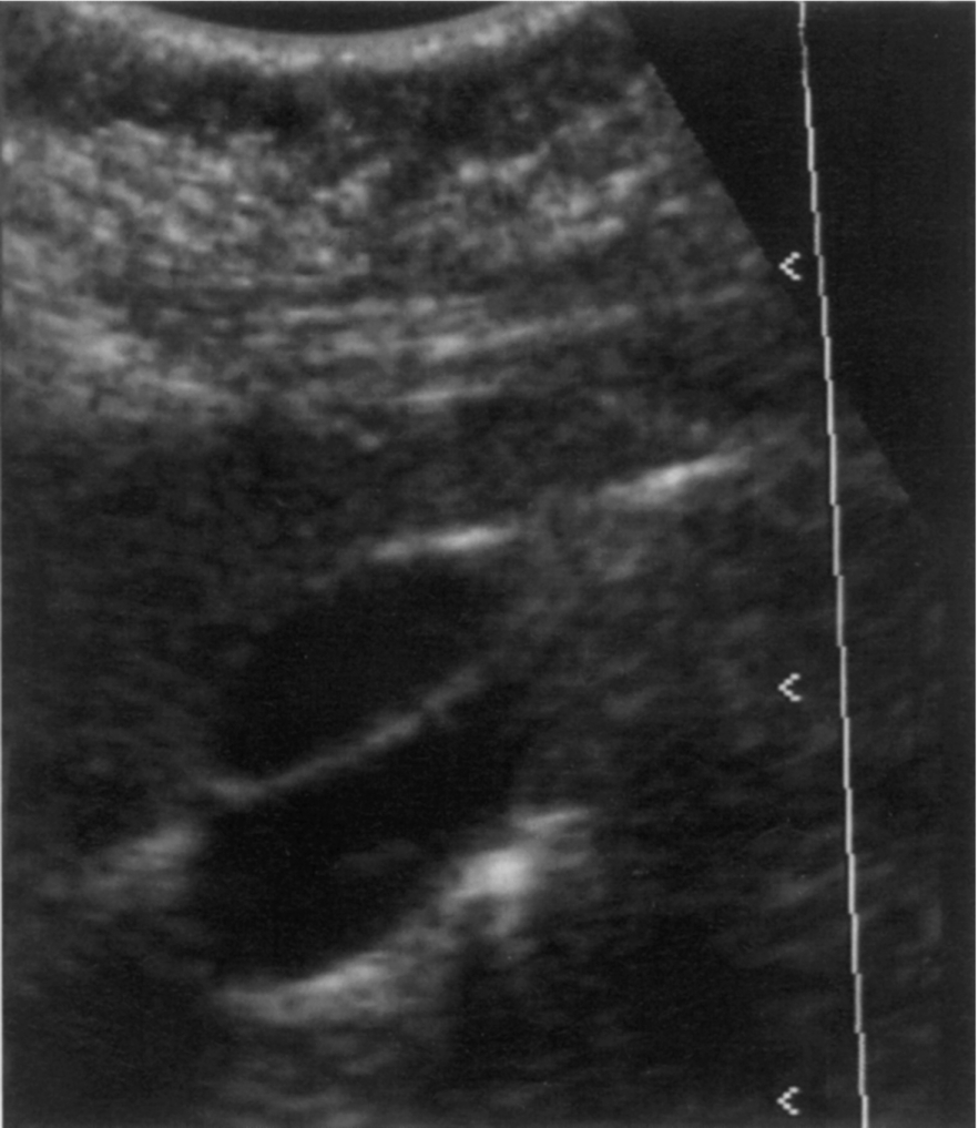 Fig. 3.3