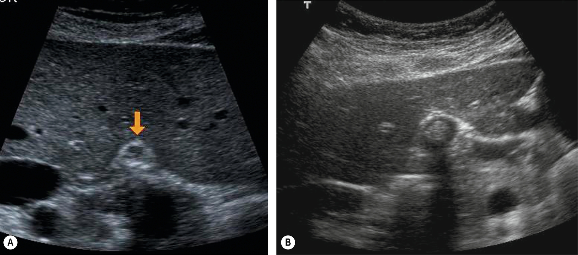 Fig. 3.4
