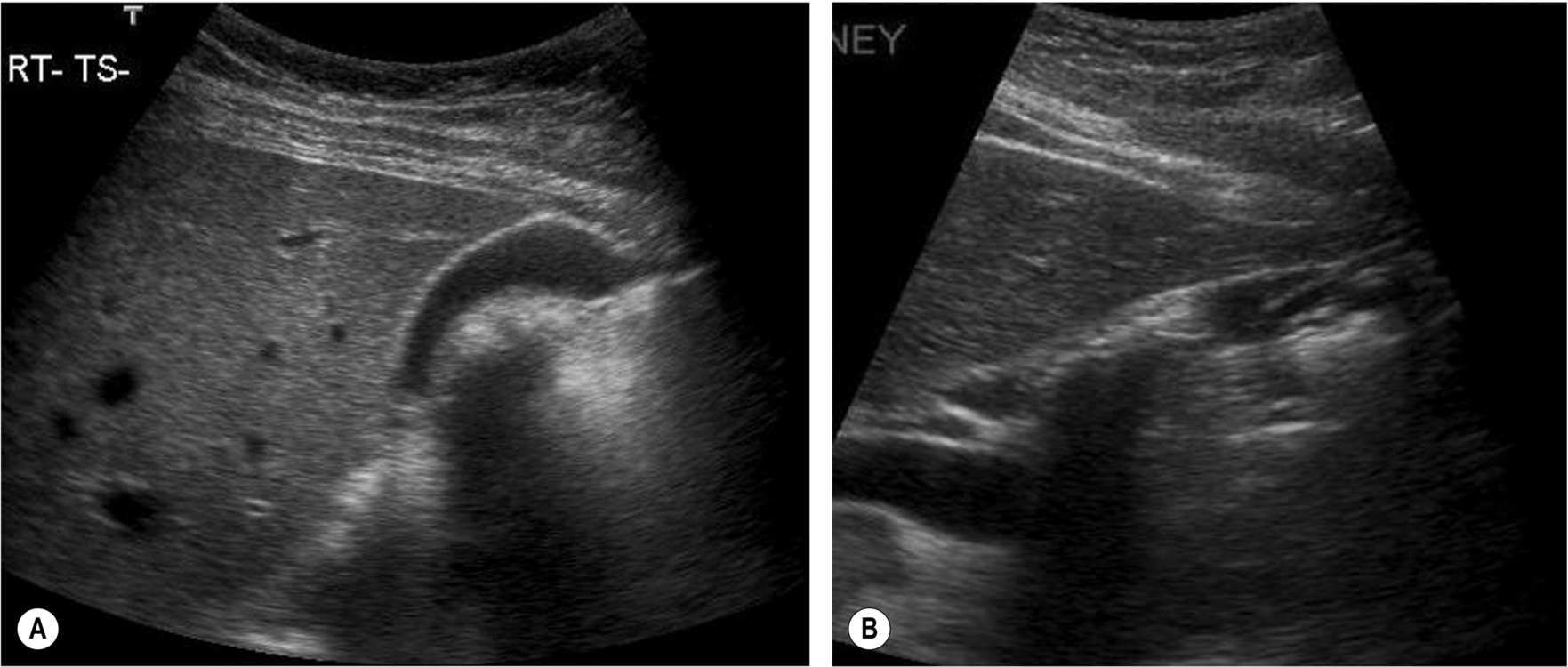 Fig. 3.5