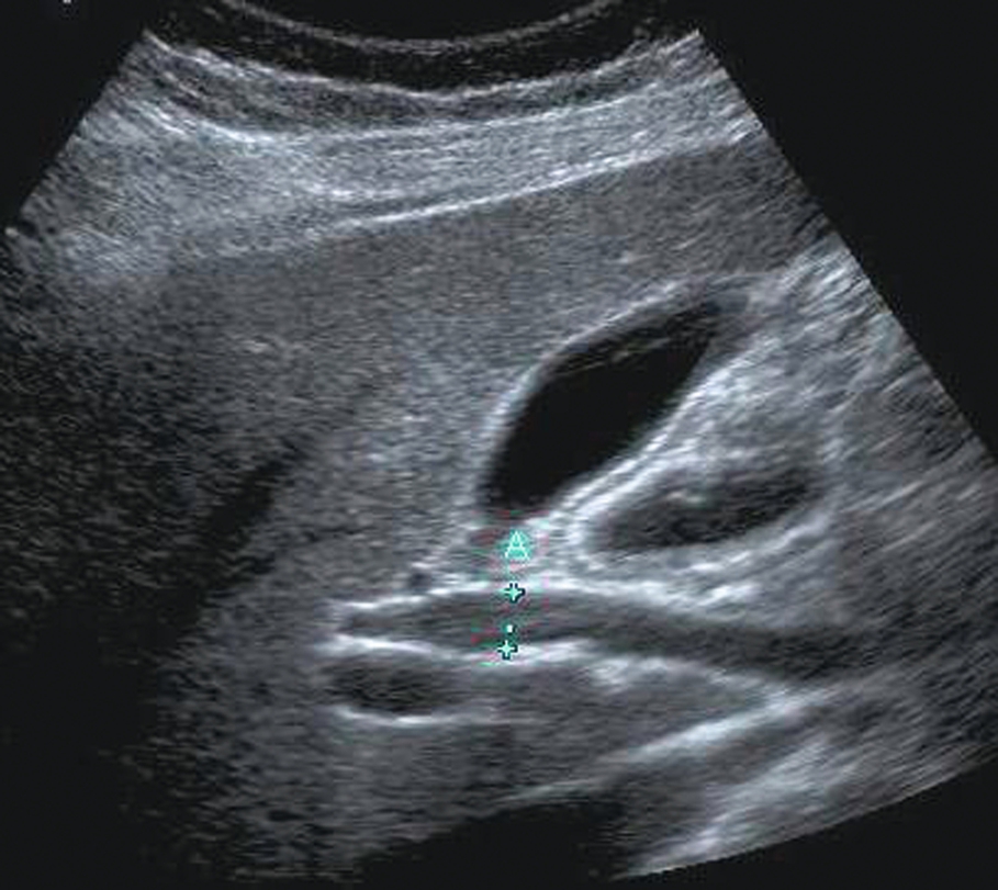 Fig. 3.6