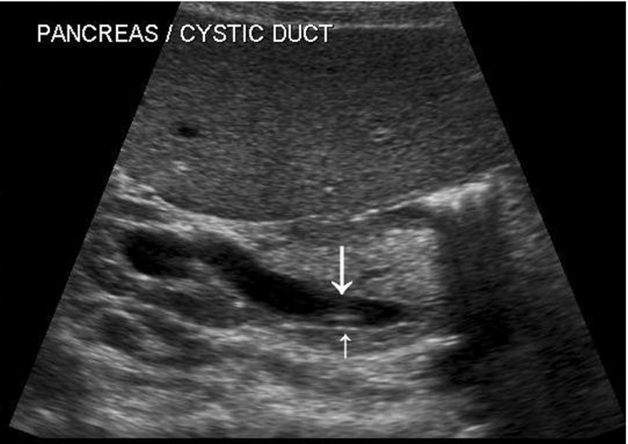 Fig. 3.7