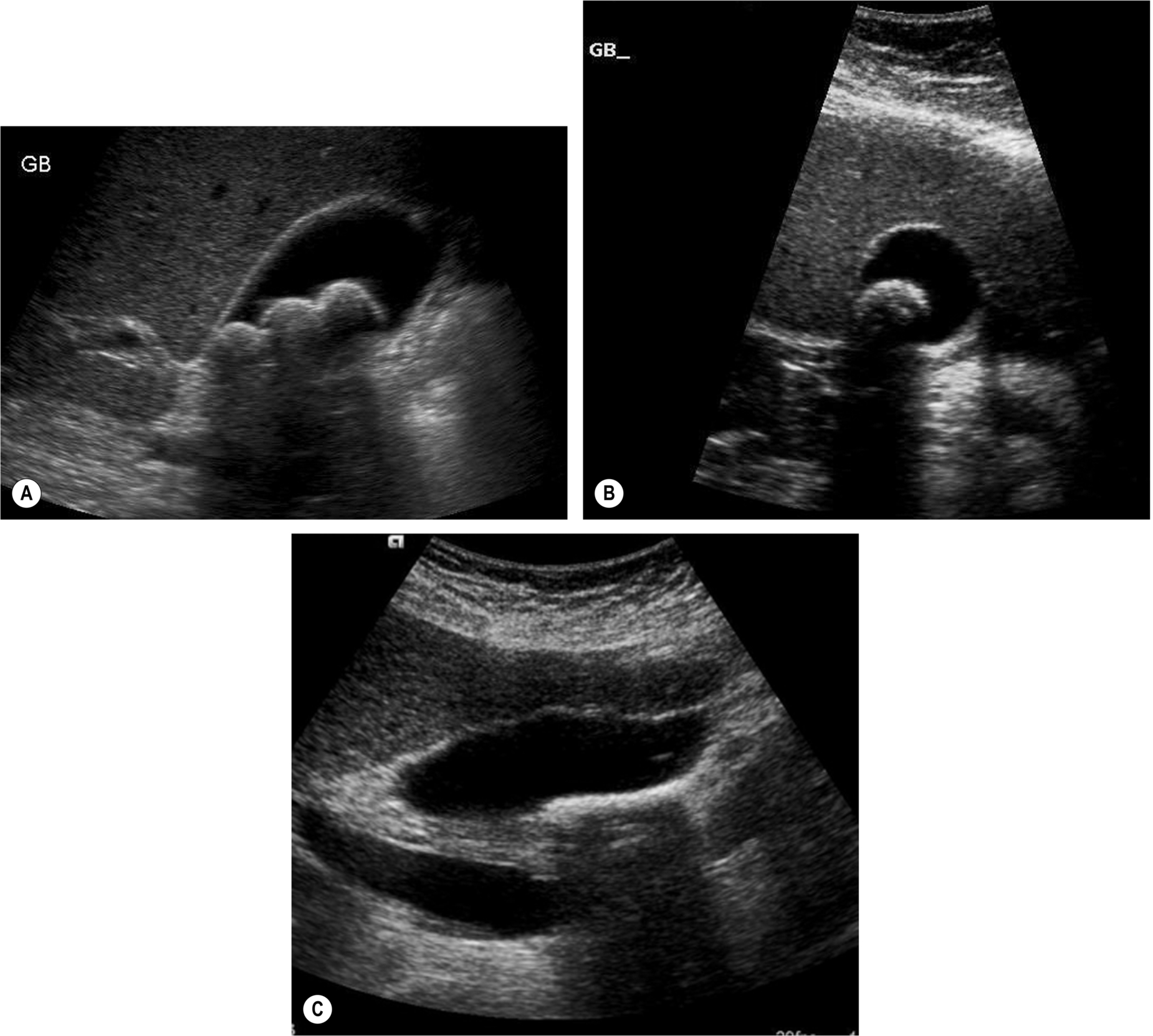 Fig. 3.11