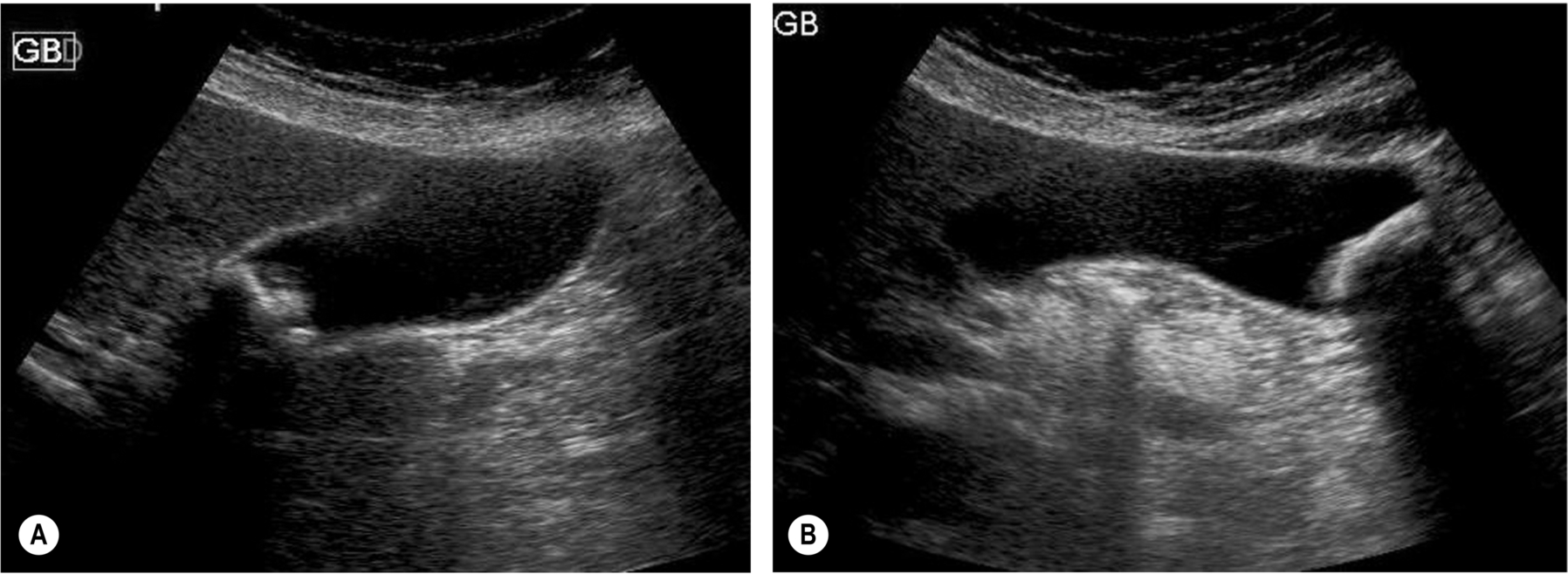 Fig. 3.12