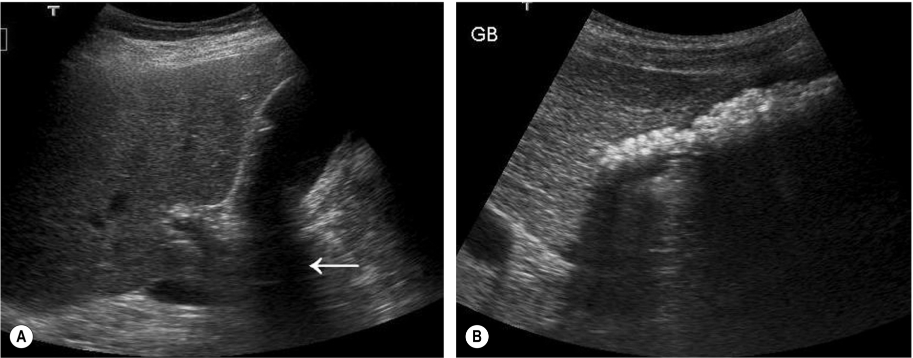 Fig. 3.13