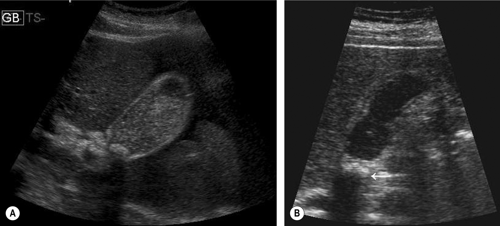 Fig. 3.18