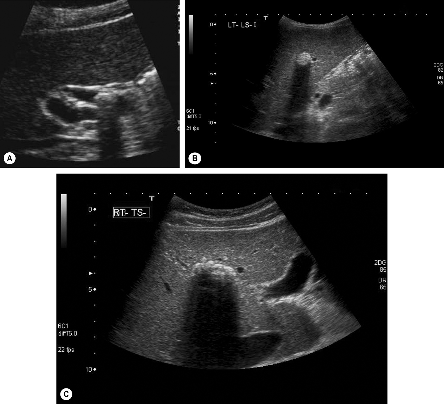 Fig. 3.19