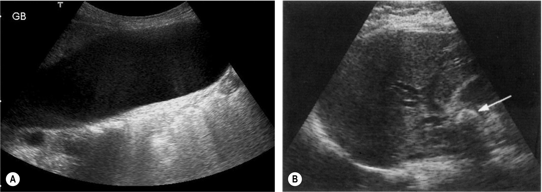 Fig. 3.24