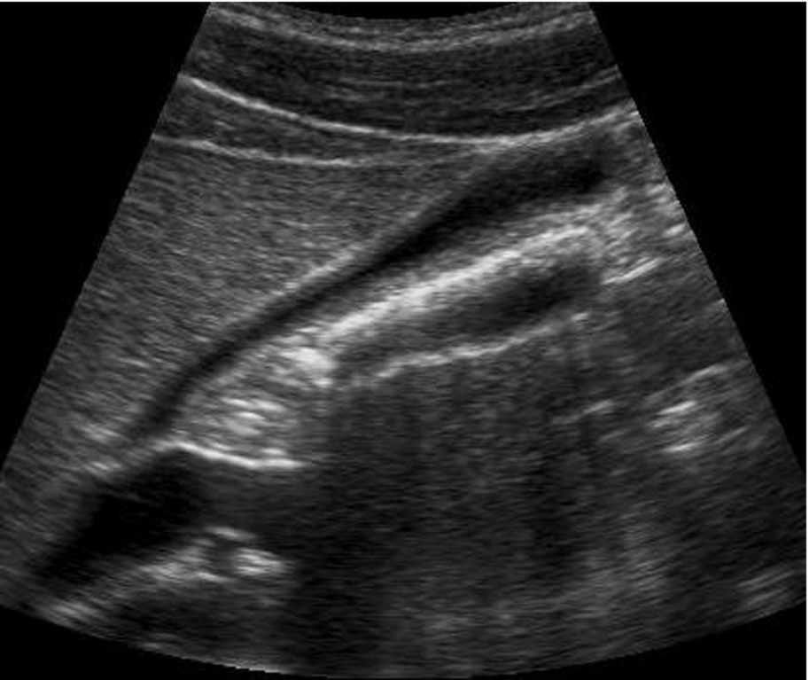 Fig. 3.25