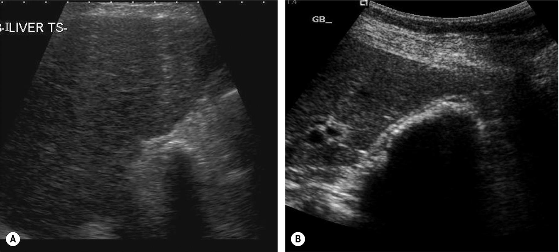 Fig. 3.26