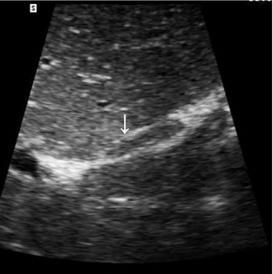 Fig. 3.27