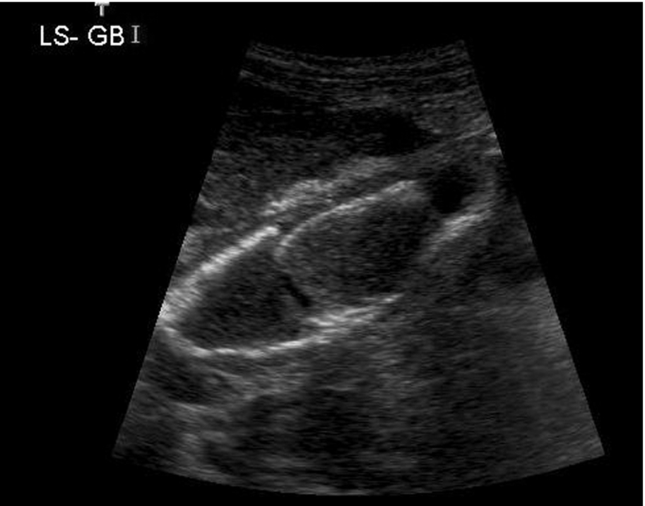 Fig. 3.28