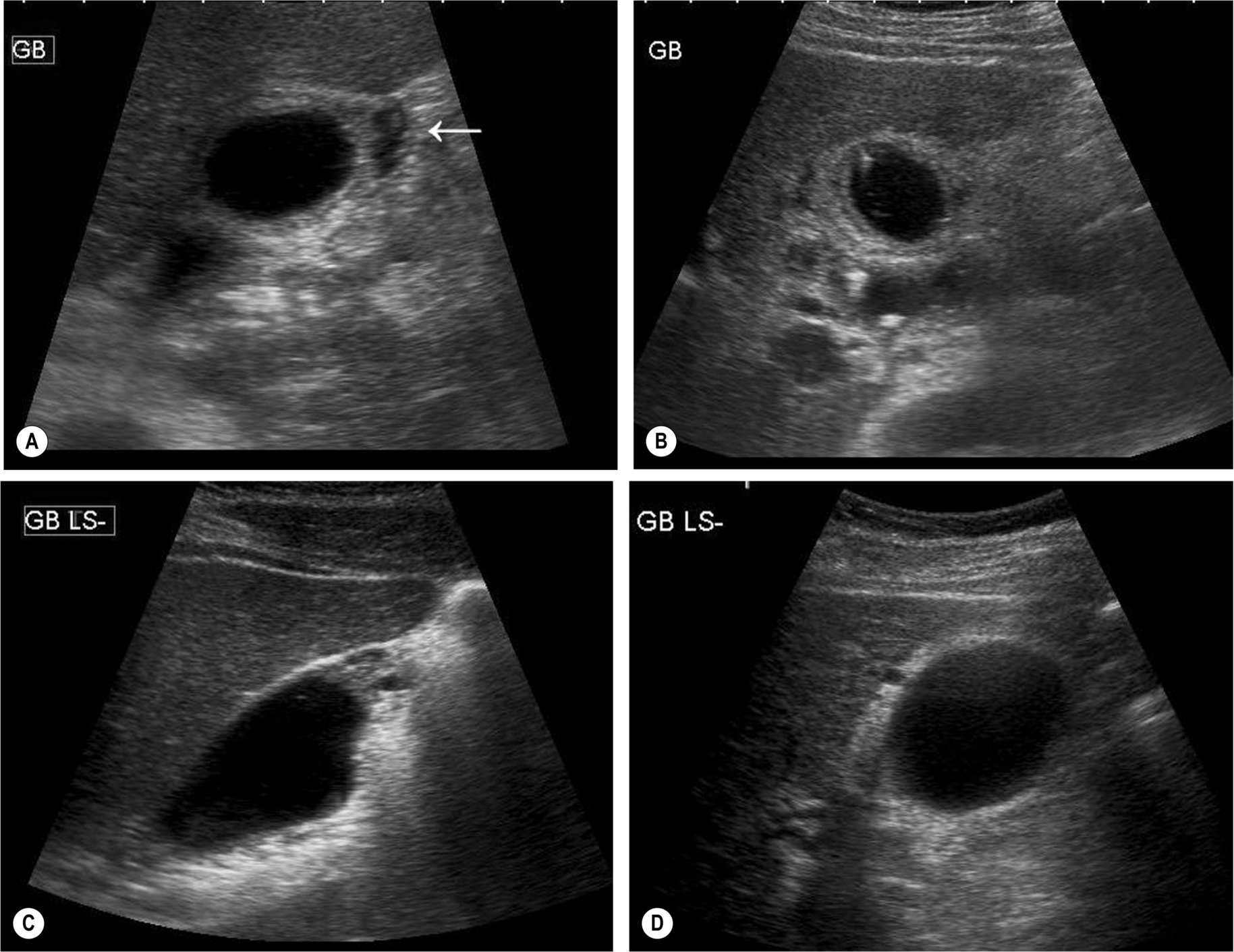 Fig. 3.29