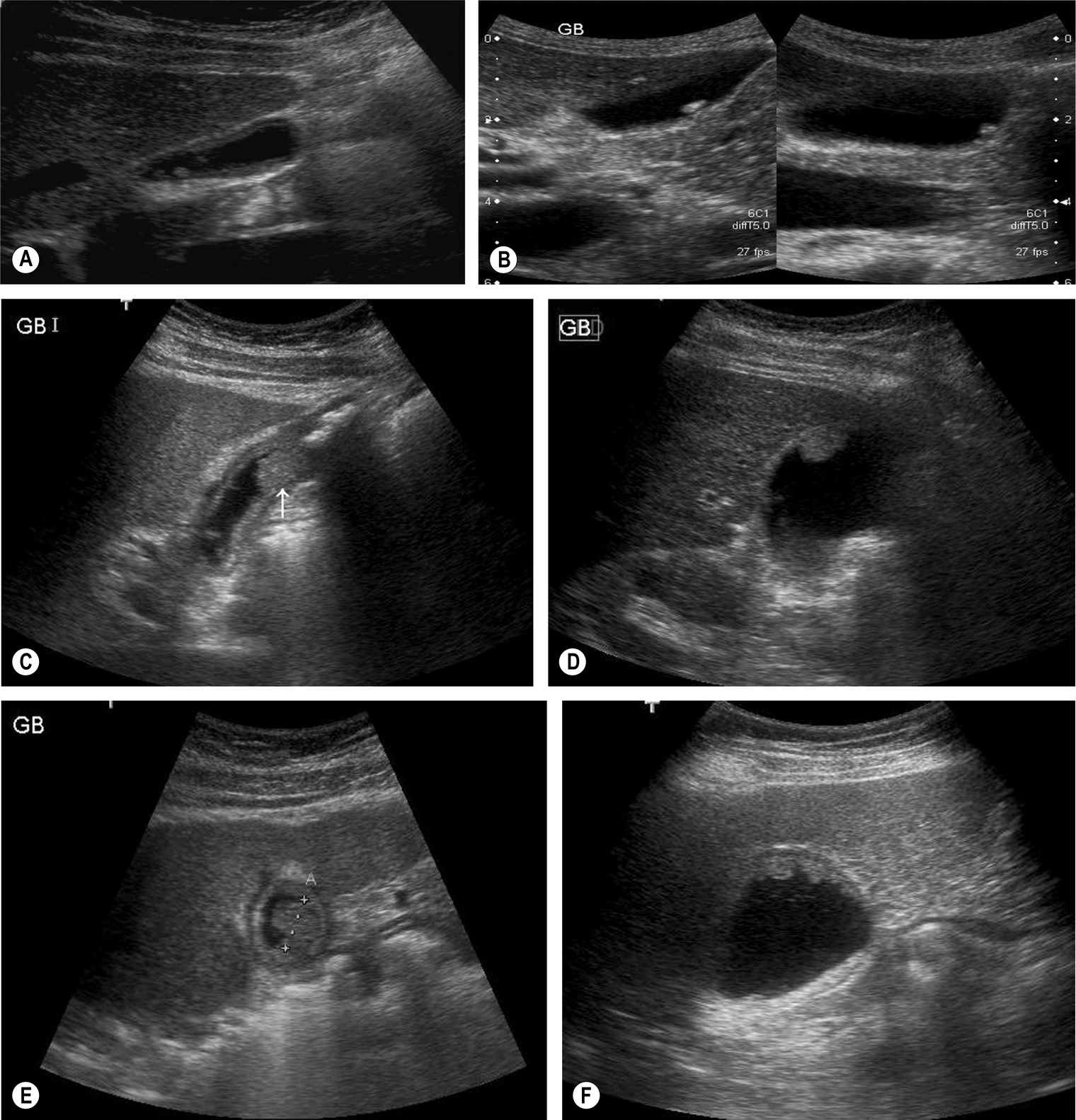 Fig. 3.30
