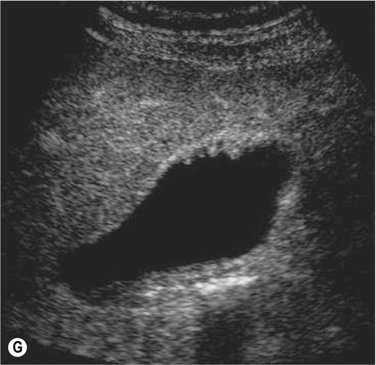 Fig. 3.30