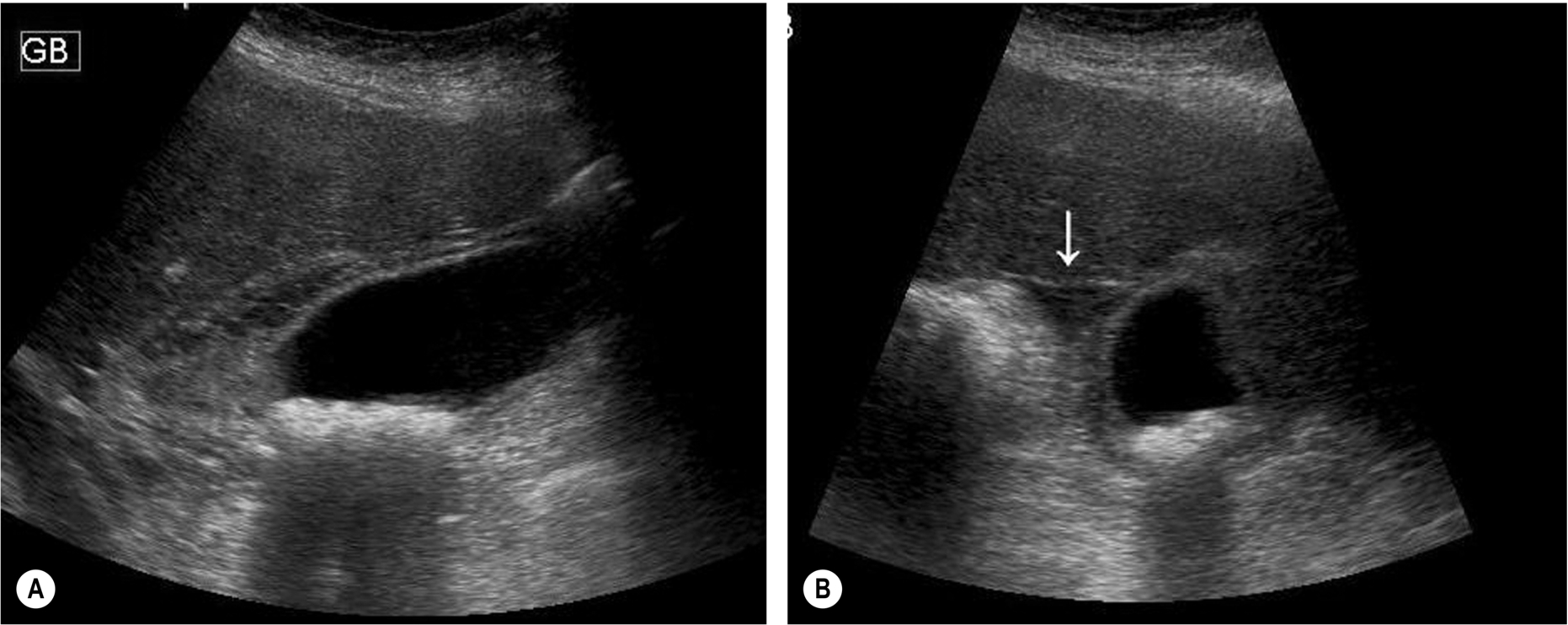 Fig. 3.32