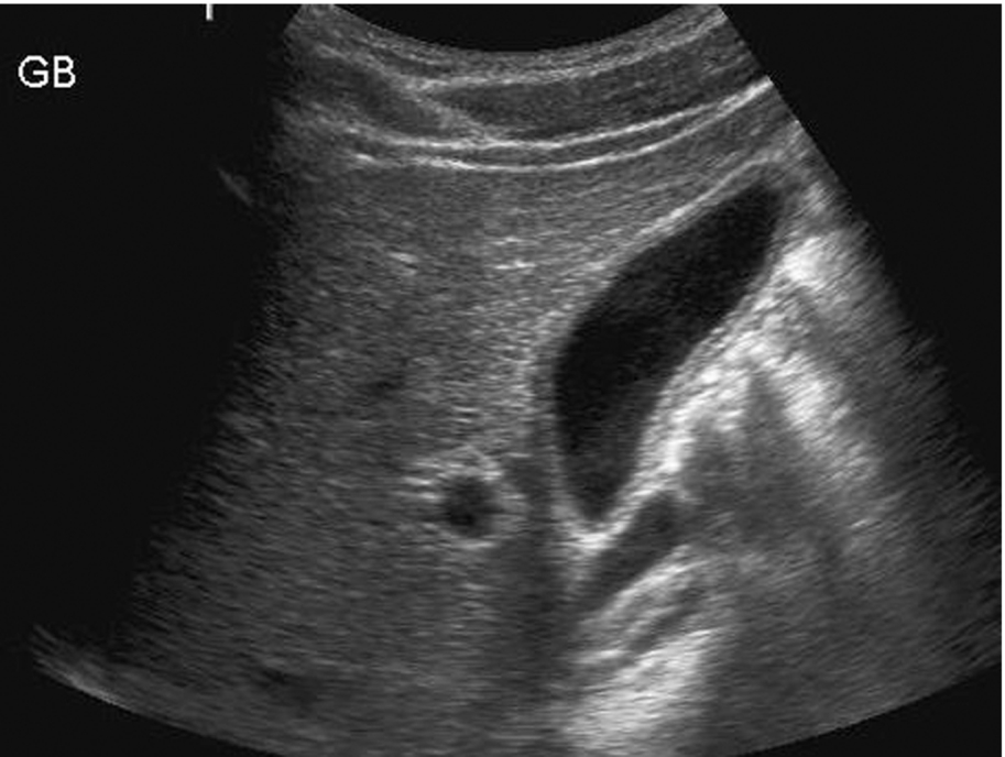 Fig. 3.33