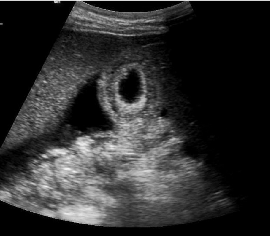 Fig. 3.34