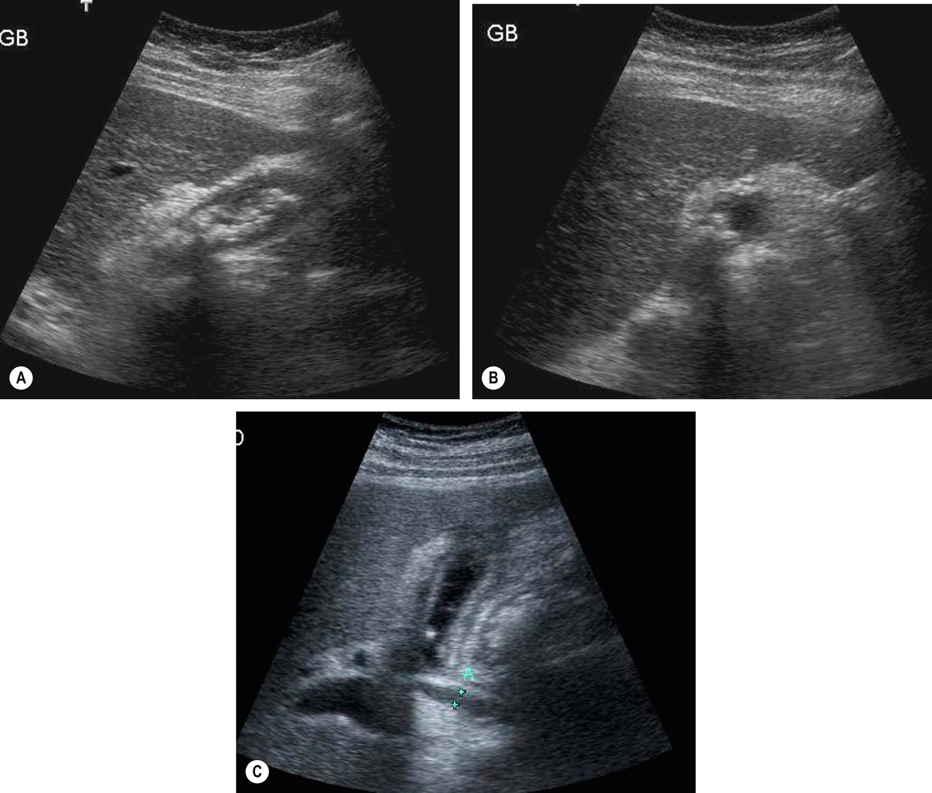 Fig. 3.35