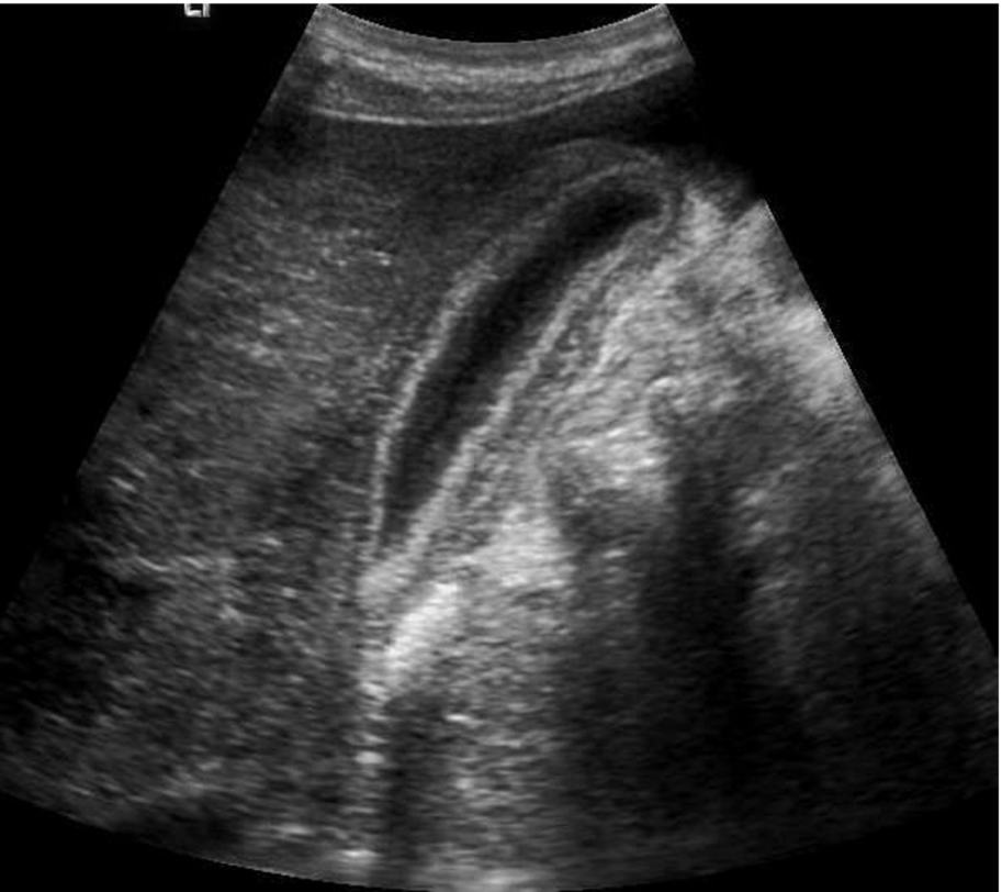 Fig. 3.36