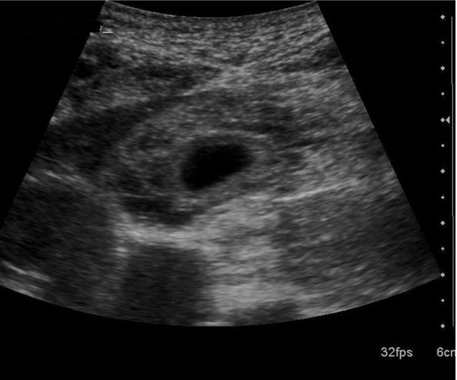 Fig. 3.37