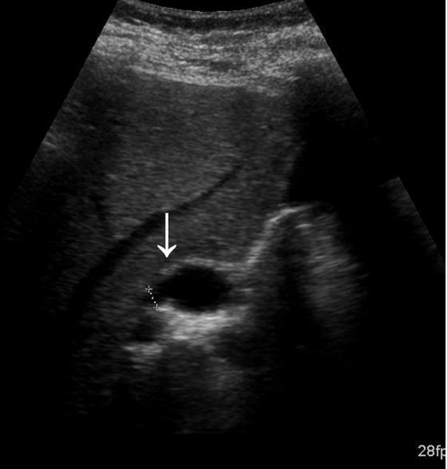 Fig. 3.46