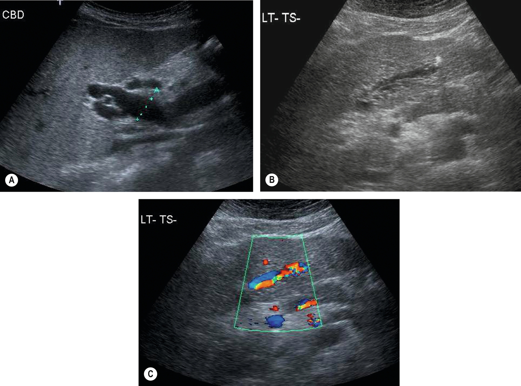 Fig. 3.48