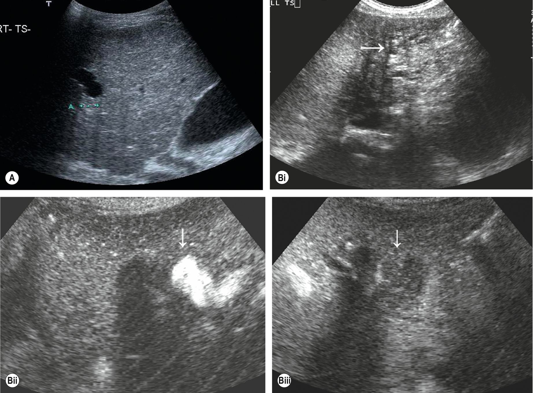 Fig. 3.51