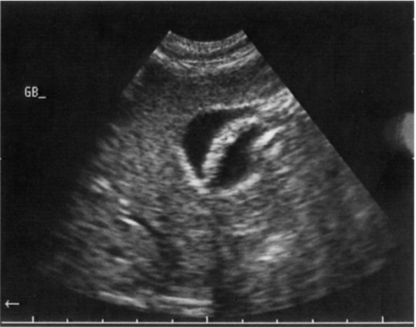 Fig. 3.53