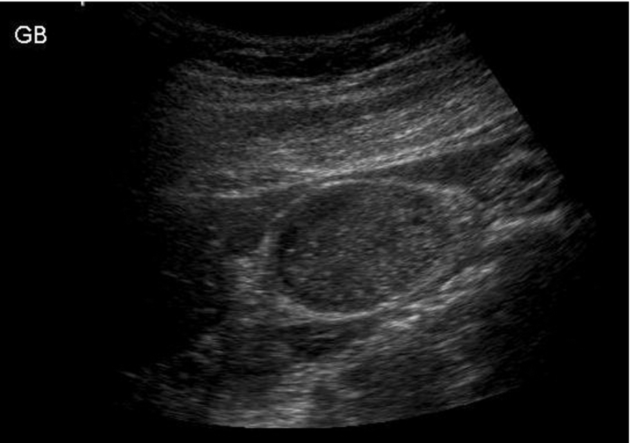 Fig. 3.55