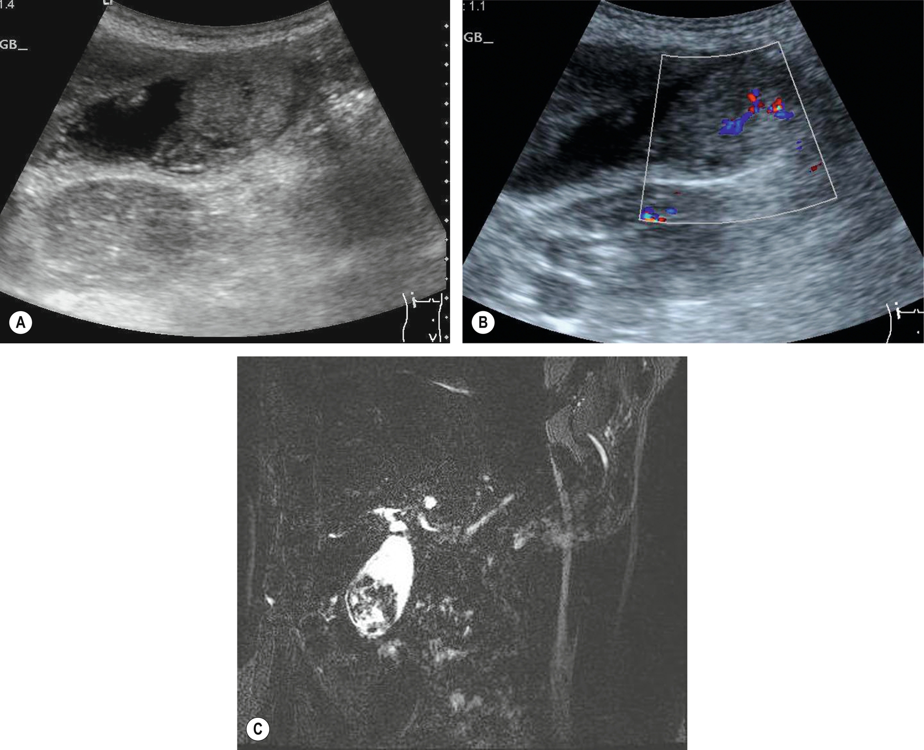 Fig. 3.57
