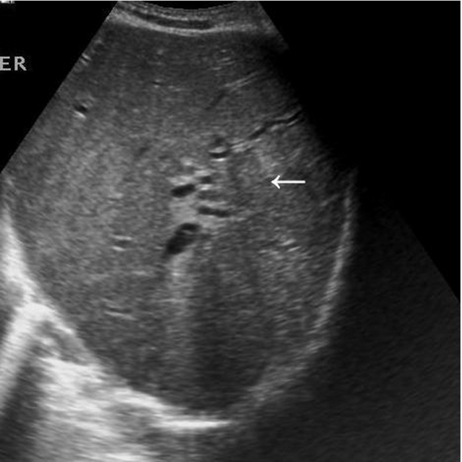 Fig. 3.60